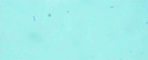 Darkhan Urguu Residence water softener hardness treated